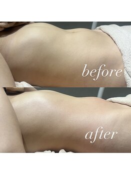 ヴィディトゥ(vidyto)/BODY【ポッカリお腹、むくみ】