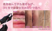 アンフィア(Anfia)