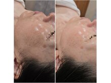 イチグラム(Ichi Glam)の雰囲気（即効性・持続性の高い施術で肌質を改善し、健康なお肌へ導きます）