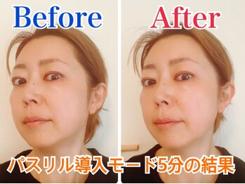 コスメティックスアンドビューティ グランディール/【美顔器】５分で驚きの効果！