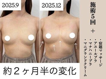 ソワ(soie)/圧倒的なハリとボリューム