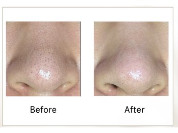 リル(Rire)/Before→After