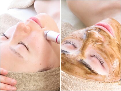 アン(anne)の写真