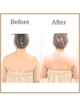 サロンルーチェ(Salon Luce)/20代ビフォーアフター/施術6回