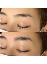 シュエット(Chouette)/ハリウッドブロウリフト