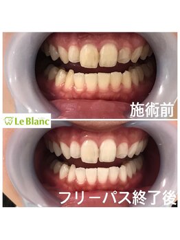 ルブラン 奈良店(Le Blanc)/人気No.1 フリーパス！！