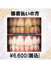  【都度払いでの施術を受けたい方】美白セルフホワイトニング40分¥6,600