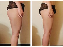 マナ(mana)/30代脚ダイエット／下半身