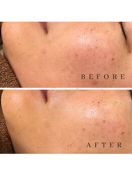 エリンダ(E LINDA)/WAXXXX