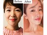 ハーブピーリング【つや水光肌】韓国女優肌になれる潤肌フェイシャル♪45分