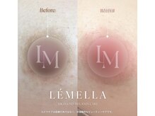 ダオンプライベートケアサロン 表参道(DAON PRIVATE CARE SALON)の雰囲気（今話題の韓国発メラミンケア、シェア率No.1"LEMELLA"導入サロン）