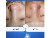 ジュエリースキン(JewelrySkin)/憧れのツルン肌へ。