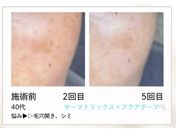 リル(Rire)/Before→After