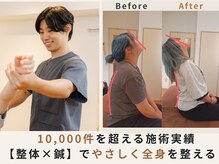 10,000件を超える施術実績！整体×鍼で姿勢改善！