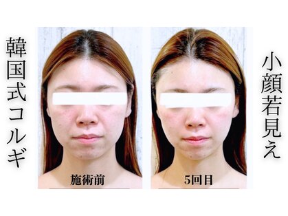 リリーガーデン 手稲店(Lily Garden)の写真