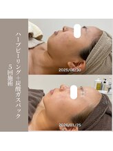 コンバートビューティーオタイ(ConBert Beauty otai)/ノーファンデ肌へ♪