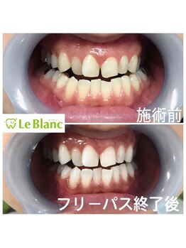 ルブラン 奈良店(Le Blanc)/メンテナンスが大事!