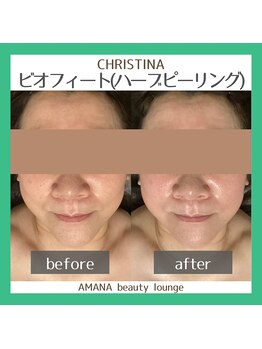 アマナ(AMANA)/60代のお客様ももっちりお肌に♪