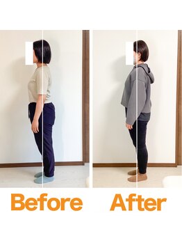 整体院ひなた 都城院/猫背反り腰と朝の腰痛が改善