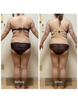 ヨサパーク ベア(YOSA PARK Beat)/30代女性 before after