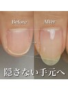 隠さなくなった爪♪