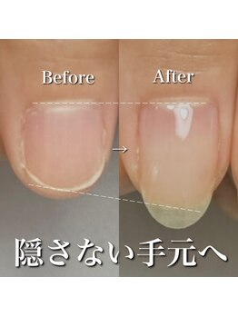 リリー/隠さなくなった爪♪