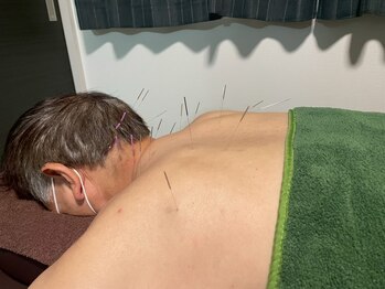 エザキ鍼灸院 接骨院(EZAKI鍼灸院 接骨院)の写真/デスクワークで凝り固まった首・肩こりに♪いつも頑張っている自分へのご褒美としていかがでしょうか♪