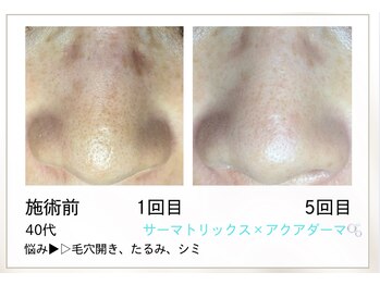 リル(Rire)/Before→After