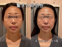 薬手名家 心斎橋店/お客様ビフォーアフター