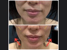 キュライム 熊本(CURAIM)/造顔πセラピー【40代女性】