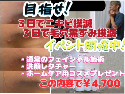 スノードロップ(snowdrop)の写真