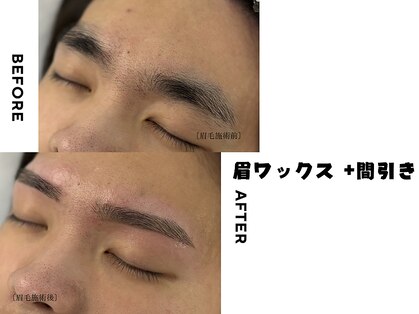 ミミ 大阪(MIMI)の写真