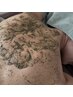 【新規】剥離あり★背中のハーブピーリング★期間限定24000→23000★爆速効果
