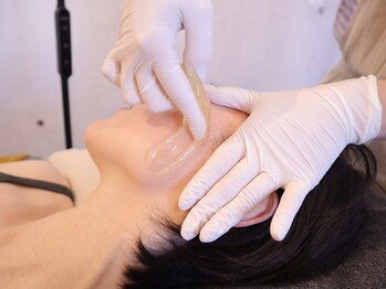 マベル シュガーリング(Mabelle)/人気☆お顔脱毛