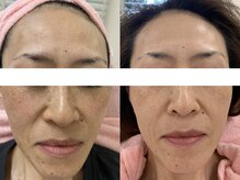 サクラ(SAKURA)/マイナス5歳は夢ではない