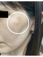 リメイククリニカルビューティー(Remake clinical beauty)/長年の悩みにも◎