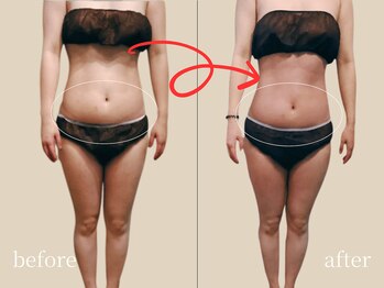 宮(Miya)/お腹回りスッキリ！