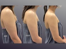 クレビア(CREBIA)/二の腕も大人気！