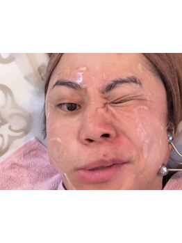 小顔になりたい