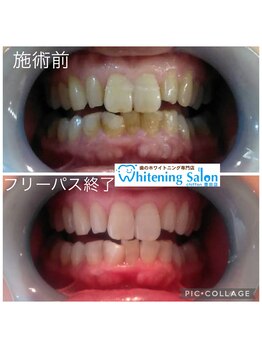 シフォン 豊田店/3週間フリーパス終了のお客様