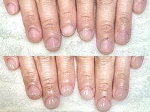 グラシナ なんば店/深爪/自爪育成/フィルイン