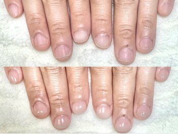 グラシナ なんば店/深爪/自爪育成/フィルイン