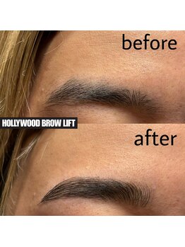 ヴィシアス(VIXIAS)/ハリウッドブロウリフト