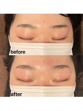 パピヨン(papillon)/ハリウッドブロウリフト【HBL】