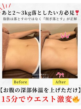 エーシーサロン 六本木店(acsalon)の写真/【ウエスト激変】次世代エステ★最新痩身マシンでウエスト職人が理想のくびれを造形!