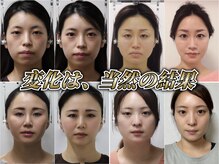 さつま骨格矯正とは