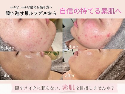 エン(en.)の写真