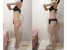 アルメリア(Armeria)/【結果写真　背中二の腕のみ】