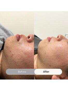 シアー(SHEER)/■お肌改善!