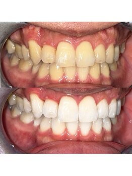 ライトビューティー 池袋店(LightBeauty)/症例写真